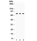 Western blot testing of TGM2 antibody and Lane 1: rat liver, 2. rat ovary and 3: HeLa lysate. Predicted/observed molecular weight: ~ 78 kDa.