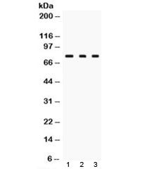Western blot testing of TGM2 antibody and Lane 1: rat liver, 2. rat ovary and 3: HeLa lysate. Predicted/observed molecular weight: ~ 78 kDa.