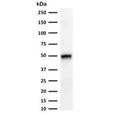 Western blot testing of human thymus tissue and HCT-116 cell lysate with CK15 antibody (clone CTKN15-1). Expected molecular weight ~50 kDa.