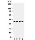 Western blot testing of 1) human placenta, 2) HeLa, 3) HUT and 4) Jurkat lysate with PINX1 antibody. Predicted/observed molecular weight ~37 kDa.