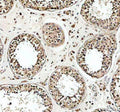 IHC staining of FFPE human testis tissue with USP5 antibody, HRP-secondary and DAB substrate. HIER: boil tissue sections in pH8 EDTA for 20 min and allow to cool before testing.