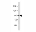 Western blot testing of Dnmt3b antibody at 1:2000 dilution + T47D lysate; Predicted molecular weight: 95 kDa.