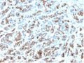 IHC staining of FFPE human stomach with MICA antibody (clone MICA/4443). HIER: boil tissue sections in pH 9 10mM Tris with 1mM EDTA for 20 min and allow to cool before testing.