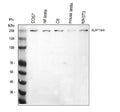 Western blot analysis of SUPT6H using anti-SPT6 antibody. Electrophoresis was performed on a 8% SDS-PAGE gel at 80V (Stacking gel) / 120V (Resolving gel) for 2 hours. Lane 1: human HEL whole cell lysates, Lane 2: human whole cell lysates, Lane 3: human SiHa whole cell lysates, Lane 4: human MCF-7 whole cell lysates. After electrophoresis, proteins were transferred to a nitrocellulose membrane at 150 mA for 50-90 min. Blocked the membrane with 5% non-fat milk/TBS for 1.5 hour at RT.