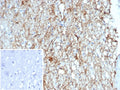 IHC staining of FFPE human brain tissue with GFAP antibody (clone GFAP/6881). Inset: PBS used in place of primary Ab (secondary Ab negative control). HIER: boil tissue sections in pH 9 10mM Tris with 1mM EDTA for 20 min and allow to cool before testing.