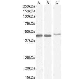 Western blot testing of A) human duodenum, B) mouse duodenum and C) rat duodenum lysate with Smooth muscle alpha Actin antibody. Predicted molecular weight: ~42 kDa.