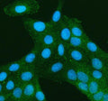 Immunofluorescent staining of TNS3 using anti-TNS3 antibody. TNS3 was detected in an immunocytochemical section of U2OS cells. Enzyme antigen retrieval was performed using IHC enzyme antigen retrieval reagent for 15 mins. The cells were blocked with 10% goat serum. And then incubated with 5 ug/ml rabbit anti-TNS3 antibody overnight at 4oC. DyLight 488 Conjugated Goat Anti-Rabbit IgG was used as secondary antibody at 1:500 dilution and incubated for 30 min at 37oC.