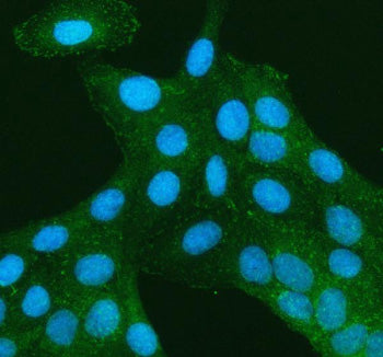 Immunofluorescent staining of TNS3 using anti-TNS3 antibody. TNS3 was detected in an immunocytochemical section of U2OS cells. Enzyme antigen retrieval was performed using IHC enzyme antigen retrieval reagent for 15 mins. The cells were blocked with 10% goat serum. And then incubated with 5 ug/ml rabbit anti-TNS3 antibody overnight at 4oC. DyLight 488 Conjugated Goat Anti-Rabbit IgG was used as secondary antibody at 1:500 dilution and incubated for 30 min at 37oC.