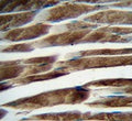 IHC testing of FFPE human skeletal muscle tissue with ILKAP antibody. HIER: steam section in pH6 citrate buffer for 20 min and allow to cool prior to staining.