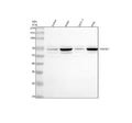 Western blot analysis of TXNRD1 using anti-TXNRD1 antibody. Lane 1: human Jurkat whole cell lysates, Lane 2: human whole cell lysates, Lane 3: human MCF-7 whole cell lysates, Lane 4: human Hela whole cell lysates. After electrophoresis, proteins were transferred to a nitrocellulose membrane at 150 mA for 50-90 min. Blocked the membrane with 5% non-fat milk/TBS for 1.5 hour at RT.