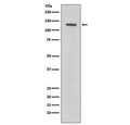 Western blot testing of human HeLa cell lysate with Rad21 antibody. Expected molecular weight: ~120 kDa (full length), 64-70 kDa (cleavage product).