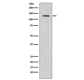 Western blot testing of human HeLa cell lysate with Rad21 antibody. Expected molecular weight: ~120 kDa (full length), 64-70 kDa (cleavage product).