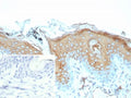 IHC staining of FFPE human skin tissue with recombinant IVL antibody (clone rIVRN/9323). Inset: PBS used in place of primary Ab (secondary Ab negative control). HIER: boil tissue sections in pH 9 10mM Tris with 1mM EDTA for 20 min and allow to cool before testing.