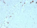 IHC staining of FFPE human uterus with recombinant ATG5 antibody. HIER: boil tissue sections in pH 9 10mM Tris with 1mM EDTA for 10-20 min and allow to cool before testing.