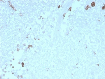IHC staining of FFPE human uterus with recombinant ATG5 antibody. HIER: boil tissue sections in pH 9 10mM Tris with 1mM EDTA for 10-20 min and allow to cool before testing.