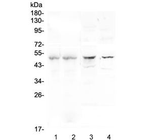 Western blot testing of 1) human placenta, 2) human U937, 3) rat brain and 4) mouse brain lysate with Properdin antibody at 0.5ug/ml. Predicted molecular weight ~51 kDa.