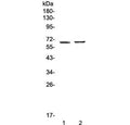 Western blot testing of 1) human placenta and 2) mouse testis lysate with RUNX1T1 antibody at 0.5ug/ml. Predicted molecular weight ~67 kDa.