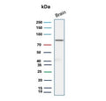 Western blot testing of human brain tissue lysate with FOXO1 antibody (clone FOXO1/9792). Predicted molecular weight ~70 kDa.