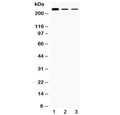 Western blot testing of 1) rat testis, 2) mouse Hepa1-6 and 3) human HepG2 lysate with TECTA antibody at 0.5ug/ml. Predicted molecular weight: ~240 kDa.