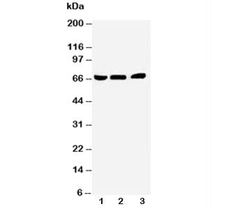 Western blot testing of NUR77 antibody and Lane 1: A431; 2: HeLa; 3: Jurkat cell lysate. Predicted molecular weight ~64/66/34kDa (isoforms 1/2/3).