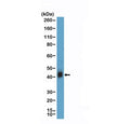 Western blot testing of human Jurkat cell lysate with recombinant CD38 antibody at 1:1000 dilution. Expected molecular weight: 34-46 kDa depending on glycosylation level.