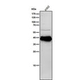 Human K562 cell lysate tested with the Phospho-CrkL (Tyr207) antibody at 1:1000 dilution for 1 hour at room temperature. A tight doublet is detected at ~40 kDa in K562 cells, running above the ~34 kDa predicted mass. The upward shift and doublet pattern are consistent with mono- and hyper-phosphorylated CrkL species, which migrate slower on SDS-PAGE than total CrkL.