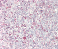 IHC testing of FFPE human tonsil tissue with GADD45A antibody. HIER: steam section in pH6 citrate buffer for 20 min and allow to cool prior to staining.