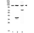 Western blot testing of 1) rat lung, 2) rat pancreas and 3) mouse pancreas with MUC1 antibody at 0.5ug/ml. Expected molecular weight: 120-500 kDa depending on glycosylation level.