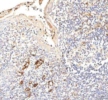 IHC staining of FFPE human tonsil tissue with Plakophilin 2 antibody. HIER: boil tissue sections in pH8 EDTA for 20 min and allow to cool before testing.