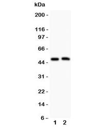 Western blot testing of Aquaporin 0 antibody and Lane 1: mouse spleen; 2: mouse intestine; Observed size: 28-60KD, depending on level of glycosylation