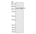 Western blot analysis of Kinase beta expression in (1) human 293 cell lysate; (2) mouse Brain lysate using PIK3CB antibody. Predicted molecular weight ~110 kDa.