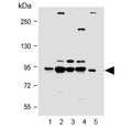 Western blot testing of human 1) A431, 2) Jurkat, 3) MCF7, 4) K562 and 5) rat brain lysate with PI3KR1 antibody. Predicted molecular weight ~84 kDa.