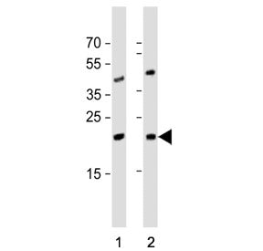 Western blot testing of 1) human Jurkat and 2) mouse testis tissue lysate with ORMDL3 antibody. Predicted molecular weight ~17 kDa.