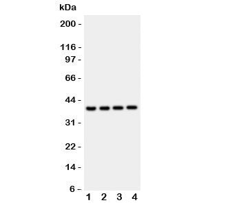 Western blot testing of Cathepsin D antibody and mouse samples: 1: liver; 2: brain; 3: thymus; 4: Neuro-2a lysate. Expected molecular weight: 43-46 kDa, 28 kDa (heavy chain), 15 kDa (light chain).