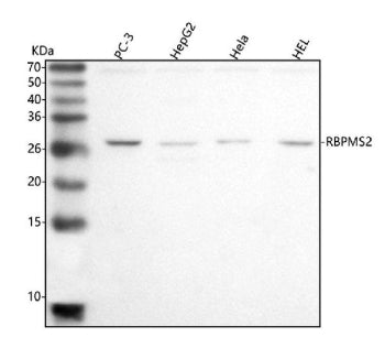 Western blot analysis of RBPMS2 using anti-RBPMS2 antibody. Lane 1: human PC-3 whole cell lysates, Lane 2: human HepG2 whole cell lysates, Lane 3: human Hela whole cell lysates, Lane 4: human HEL whole cell lysates. After electrophoresis, proteins were transferred to a nitrocellulose membrane at 150 mA for 50-90 min. Blocked the membrane with 5% non-fat milk/TBS for 1.5 hour at RT.