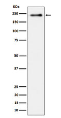 Western blot analysis of Phospho-LRP6 (S1490) expression in lysate from human HeLa cells treated with Calyculin, using Phospho-LRP6 (Ser1490) antibody. A strong band is detected at ~220-230 kDa, consistent with the mature, heavily N-glycosylated and hyperphosphorylated form of LRP6, which migrates slower than the ~180 kDa unglycosylated core polypeptide.