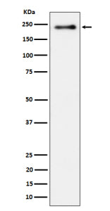 Western blot analysis of Phospho-LRP6 (S1490) expression in lysate from human HeLa cells treated with Calyculin, using Phospho-LRP6 (Ser1490) antibody. A strong band is detected at ~220-230 kDa, consistent with the mature, heavily N-glycosylated and hyperphosphorylated form of LRP6, which migrates slower than the ~180 kDa unglycosylated core polypeptide.