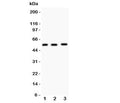 Western blot testing of MMP14 antibody and Lane 1: human placenta; 2: HeLa; 3: U87 lysate. Predicted molecular weight: ~66/54kDa.