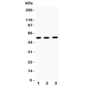 Western blot testing of MMP14 antibody and Lane 1: human placenta; 2: HeLa; 3: U87 lysate. Predicted molecular weight: ~66/54kDa.