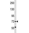 ABCF2 antibody western blot analysis in human K562 lysate. Predicted molecular weight ~71 kDa.