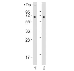Western blot testing of human 1) HeLa and 2) U-2 OS cell lysate with CLEC4F antibody. Predicted molecular weight ~66 kDa.