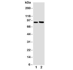 Western blot testing of FGFR3 antibody and Lane 1: U87; 2: SGC cell lysate. Predicted molecular weight: 87-135 kDa depending on glycosylation level.
