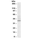 Western blot testing of human kidney lysate with CDK10 antibody at 2ug/ml. Predicted molecular weight: ~41kDa.