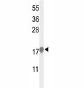 Western blot analysis of p21 antibody and HeLa lysate