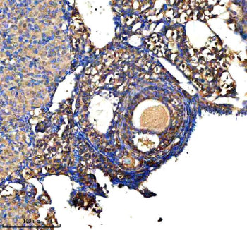 Immunohistochemical staining of GSTM2 using anti-GSTM2 antibody. GSTM2 was detected in a paraffin-embedded section of mouse ovary tissue. Heat mediated antigen retrieval was performed in EDTA buffer (pH 8.0, epitope retrieval solution). The tissue section was blocked with 10% goat serum. The tissue section was then incubated with 2 ug/ml rabbit anti-GSTM2 antibody overnight at 4oC. Peroxidase Conjugated Goat Anti-rabbit IgG was used as secondary antibody and incubated for 30 min at 37oC.