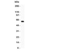 Western blot testing of DR3 antbody and COLO320 lysate. Predicted molecular weight: 45 kDa, observed at 50-70 kDa.