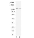Western blot testing of human 1) SMMC and 2) 293 cell lysate with TRPM5 antibody. Expected/observed molecular weight ~131 kDa.