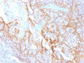 IHC testing of FFPE human tonsil tissue with Beta Catenin antibody (clone 15B8). Required HIER: boil tissue sections in 10mM Tris with 1mM EDTA, pH 9.0, for 10-20 min.