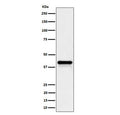 Western blot testing of human HepG2 cell lysate with WNT16 antibody. Predicted molecular weight ~41 kDa.