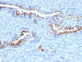 IHC staining of FFPE human endometrium with Podocalyxin antibody (clone PODXL/2184). HIER: boil tissue sections in pH 9 10mM Tris with 1mM EDTA for 20 min and allow to cool before testing.